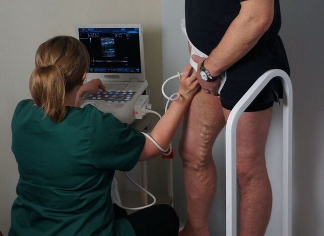 barizeetarako laser koagulazioaren aurretik zainen azterketa